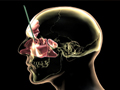 RealAge YOU And Your Body With Dr. Oz Sinusitis Video