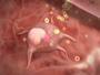 RealAge YOU And Your Body With Dr. Oz Fat Cells and Cellulite Video