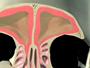 RealAge YOU And Your Body With Dr. Oz Sinusitis Video
